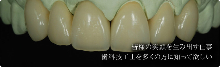 歯科技工臨床症例